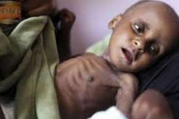 گزارش یونیسف از مرگ و معلولیت چهار هزار کودک یمنی در جنگ ائتلاف عربی